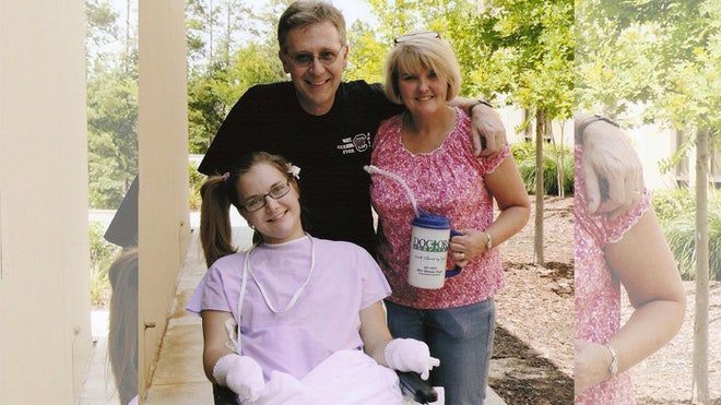 Aimee Copeland post surgery final.jpg